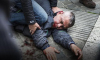 Belçikalı siyasetçi bıçaklandı! Saldırgan Türk çıktı