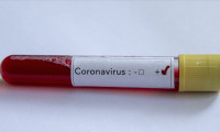 Pakistan'da 2 kişide koronavirüs tespit edildi