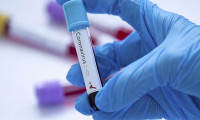 Sağlık Bakanlığı'ndan 'online' korona virüs testi