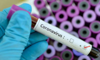 Korona virüs bir ülkeye daha sıçradı