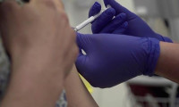 Korona virüs aşısında heyecanlandıran gelişme 