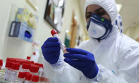 Kovid-19 aşısı için Türk bilim insanından dev adım