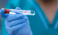 Rusya kovid-19 aşısının üretimine bu yıl başlıyor