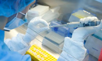 Rus R-Pharm ile AstraZeneca, Oxford'un aşısının üretimine ilişkin anlaşma imzaladı