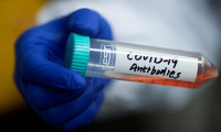 ABD'li ilaç devi virüs aşısının testlerine başladı