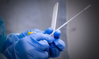 81 il valiliğine yazı: Aşısızlara PCR testi zorunluluğu kaldırıldı