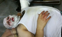 AA muhabiri Halep'te füze saldırısında yaralandı