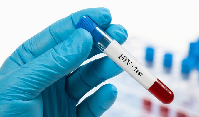 HIV virüsüne saldıran antikor geliştirildi