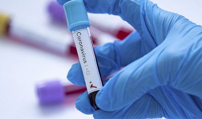 Sağlık Bakanlığı'ndan 'online' korona virüs testi