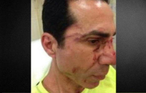 CHP'li meclis üyesine saldırı